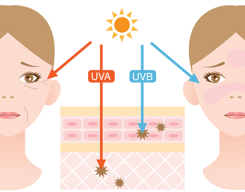 UV-A、UV-Bの影響イメージ